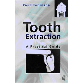 Tooth Extraction: A Practical Guide