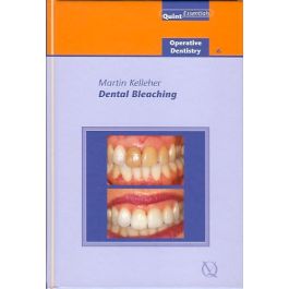 Dental Bleaching