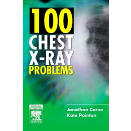 100 Chest X-Ray Problems, International Edition