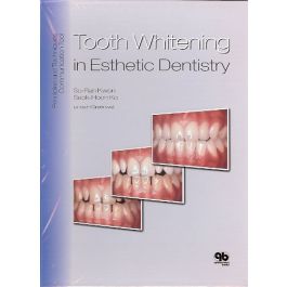 Tooth Whitening in Esthetic Dentistry: Principles and Techniques, 1st Edtion