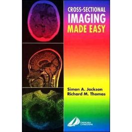 Cross-Sectional Imaging Made Easy, International Edition 