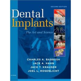 Dental Implants: The Art and Science, 2nd Edition