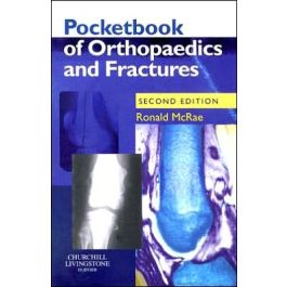 Pocketbook of Orthopaedics and Fractures, International Edition, 2nd Edition