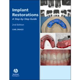 Implant Restoration Solutions: A Step-by-Step Guide, Edition 22