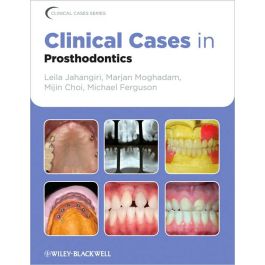 Clinical Cases in Prosthodontics / Edition 1
