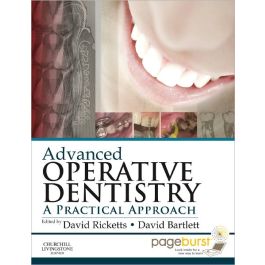 Advanced Operative Dentistry: A Practical Approach