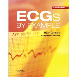 ECGs by Example, 3rd Edition