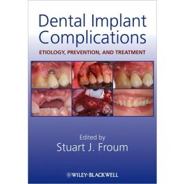 Dental Implant Complications: Etiology, Prevention, and Treatment