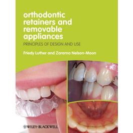 Orthodontic Retainers and Removable Appliances: Principles of Design and Use