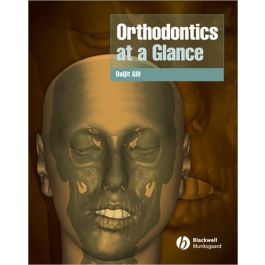Orthodontics at a Glance