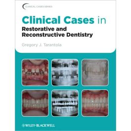 Clinical Cases in Restorative and Reconstructive Dentistry, 1st Edition