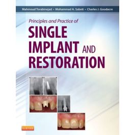 Principles and Practice of Single Implant and Restoration
