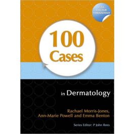 100 Cases in Dermatology 