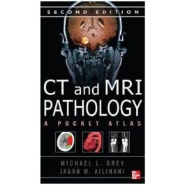 CT & MRI Pathology: A Pocket Atlas, 2nd edition