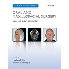 Challenging Concepts in Oral and Maxillofacial Surgery, 1st Edition