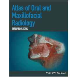 Atlas of Oral and Maxillofacial Radiology, 1st Edition