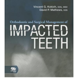 Orthodontic and Surgical Management of Impacted Teeth, 1st Edition