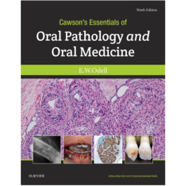 Cawson's Essentials of Oral Pathology and Oral Medicine, International Edition, 9th Edition