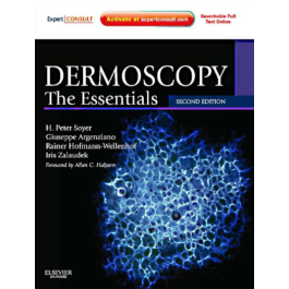 Dermoscopy: The Essentials: Expert Consult - Online and Print, 2nd Edition
