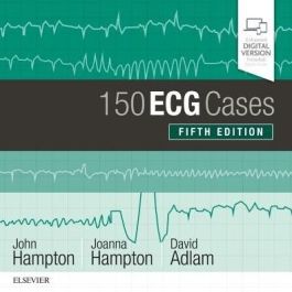150 ECG Cases, International Edition, 5th Edition