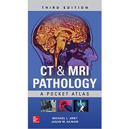 CT & MRI Pathology: A Pocket Atlas, Third Edition, 3rd Edition