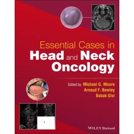Essential Cases in Head and Neck Oncology 1st Edition