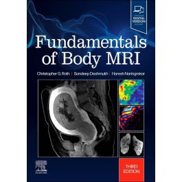 Fundamentals of Body MRI, 3rd Edition