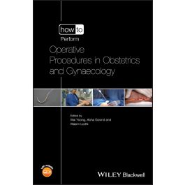 How to Perform Operative Procedures in Obstetrics and Gynaecology