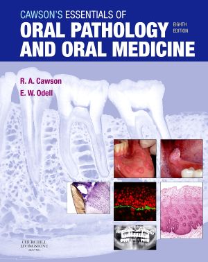 Cawson's Essentials of Oral Pathology and Oral Medicine, 8th Edition, International edition