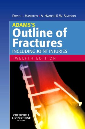 Adams`s Outline of Fractures:  Include Joint Injuries, International Edition
