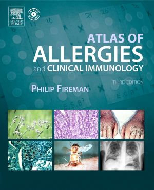 Atlas of Allergy and Clinical Immunology 3rd Edition
