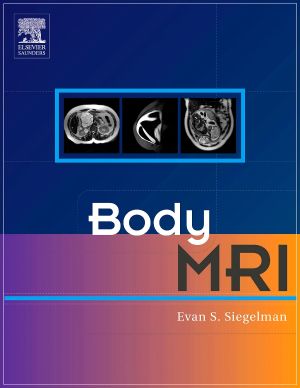 Body MRI