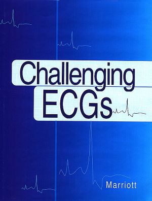 Challenging ECGs