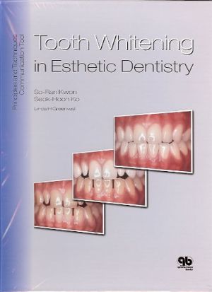 Tooth Whitening in Esthetic Dentistry: Principles and Techniques, 1st Edtion