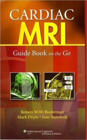 Cardiac MRI: Guide Book on the Go