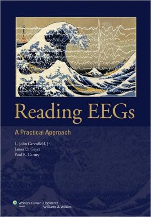 Reading EEGs: A Practical Approach