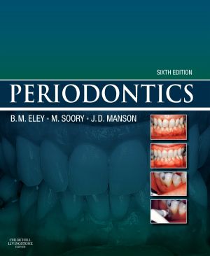 Periodontics, 6th Edition