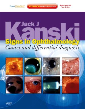 Signs in Ophthalmology: Causes and Differential Diagnosis Expert Consult - Online and Print