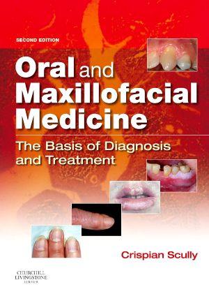 Oral and Maxillofacial Medicine: The Basis of Diagnosis and Treatment, 2nd Edition