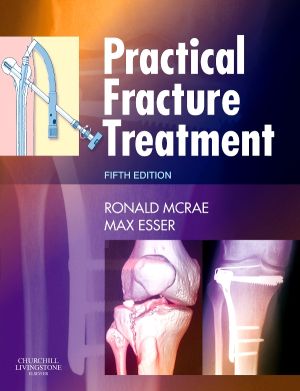 Practical Fracture Treatment, International Edition, 5th Edition