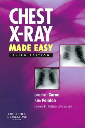 Chest X-Ray Made Easy, International Edition, 3rd Edition