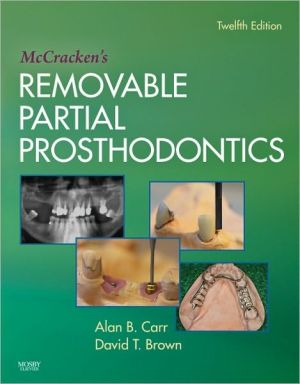 McCracken's Removable Partial Prosthodontics, Edition 12