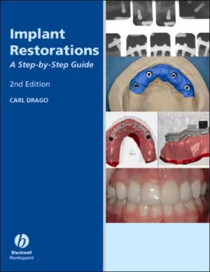 Implant Restoration Solutions: A Step-by-Step Guide, Edition 22