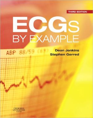 ECGs by Example, 3rd Edition