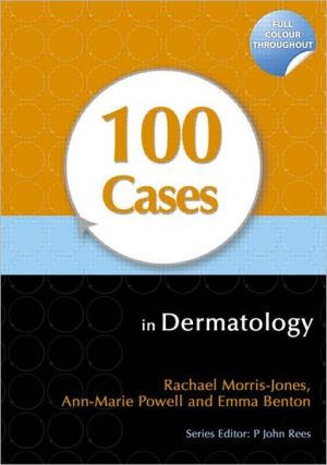 100 Cases in Dermatology 