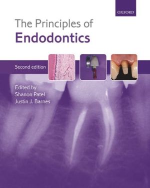 The Principles of Endodontics, second edition