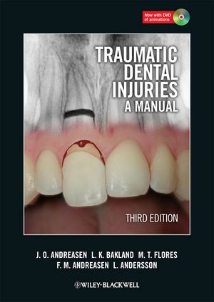 Traumatic Dental Injuries: A Manual, 3rd Edition