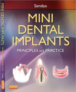 Mini Dental Implants: Principles and Practice