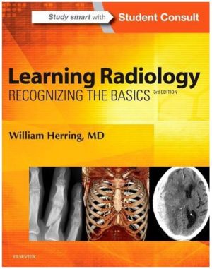 Learning Radiology: Recognizing the Basics, 3rd Edition