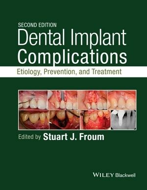Dental Implant Complications: Etiology, Prevention, and Treatment, 2nd Edition